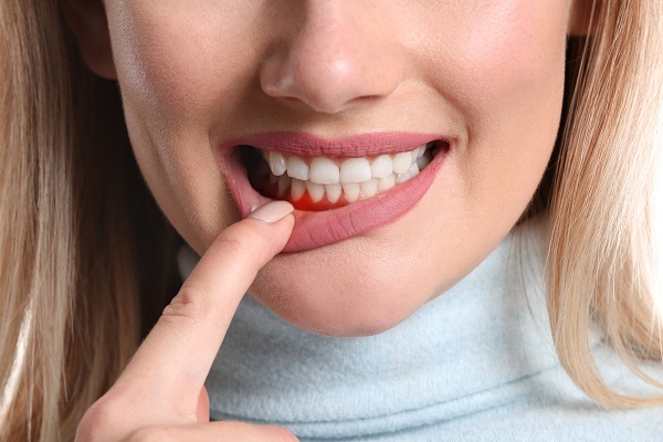 teeth cleaning services