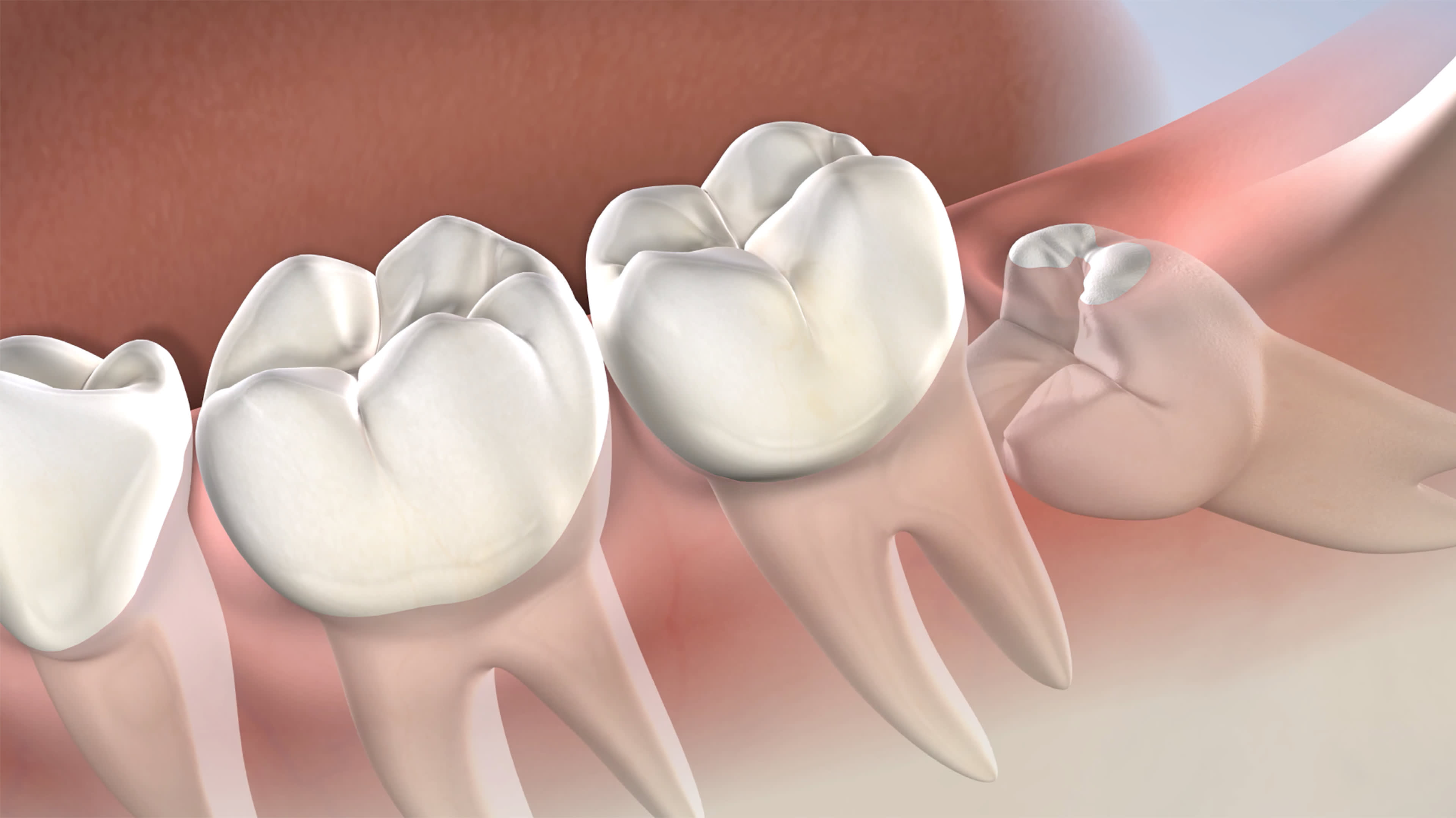 teeth cleaning services